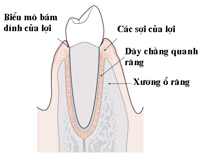 VIÊM QUANH RĂNG MẠN TÍNH